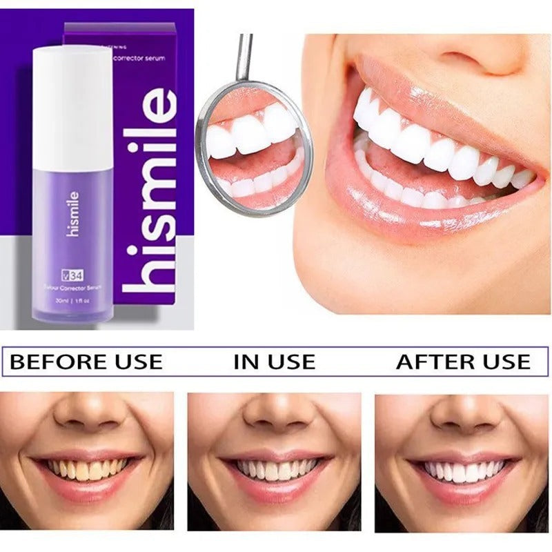 Hismile V34 Whitening Toothpaste